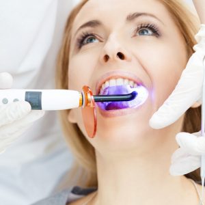 Procedimentos Esteticos Dentcare Center