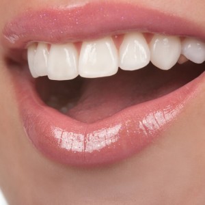 Faceta Dental